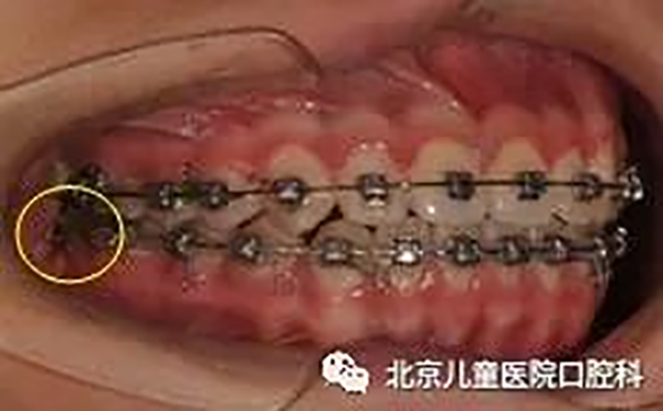 图片 187.png