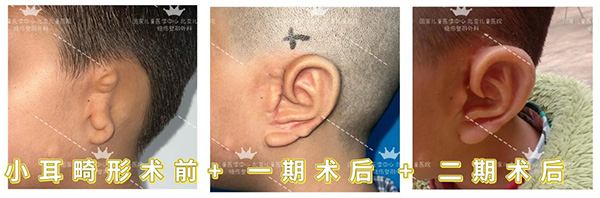 图片44.jpg