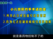 小儿惊厥（下）